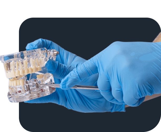 Dentist Demonstrating Dental Implant Model